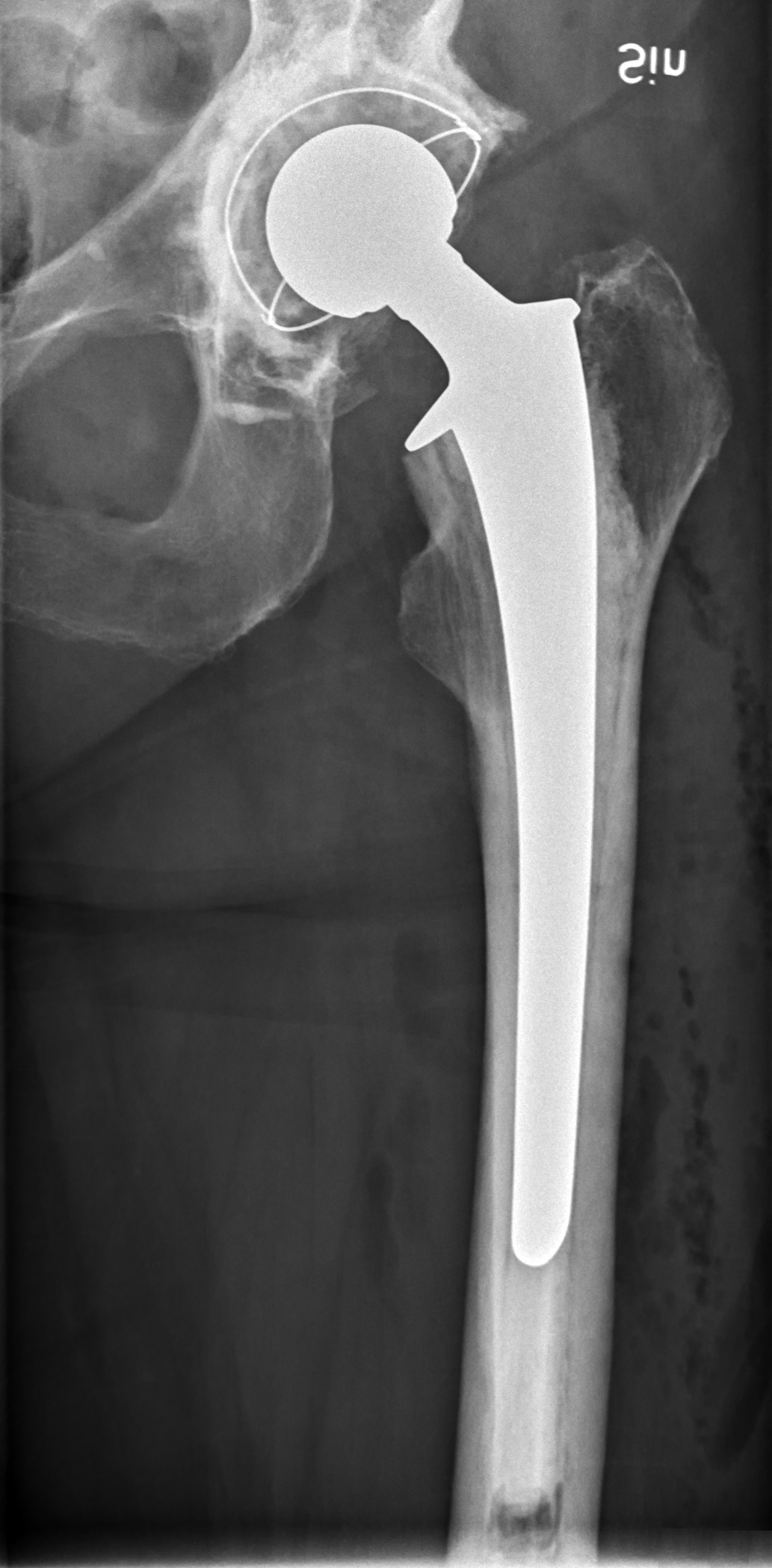 Hip joint replacement implant