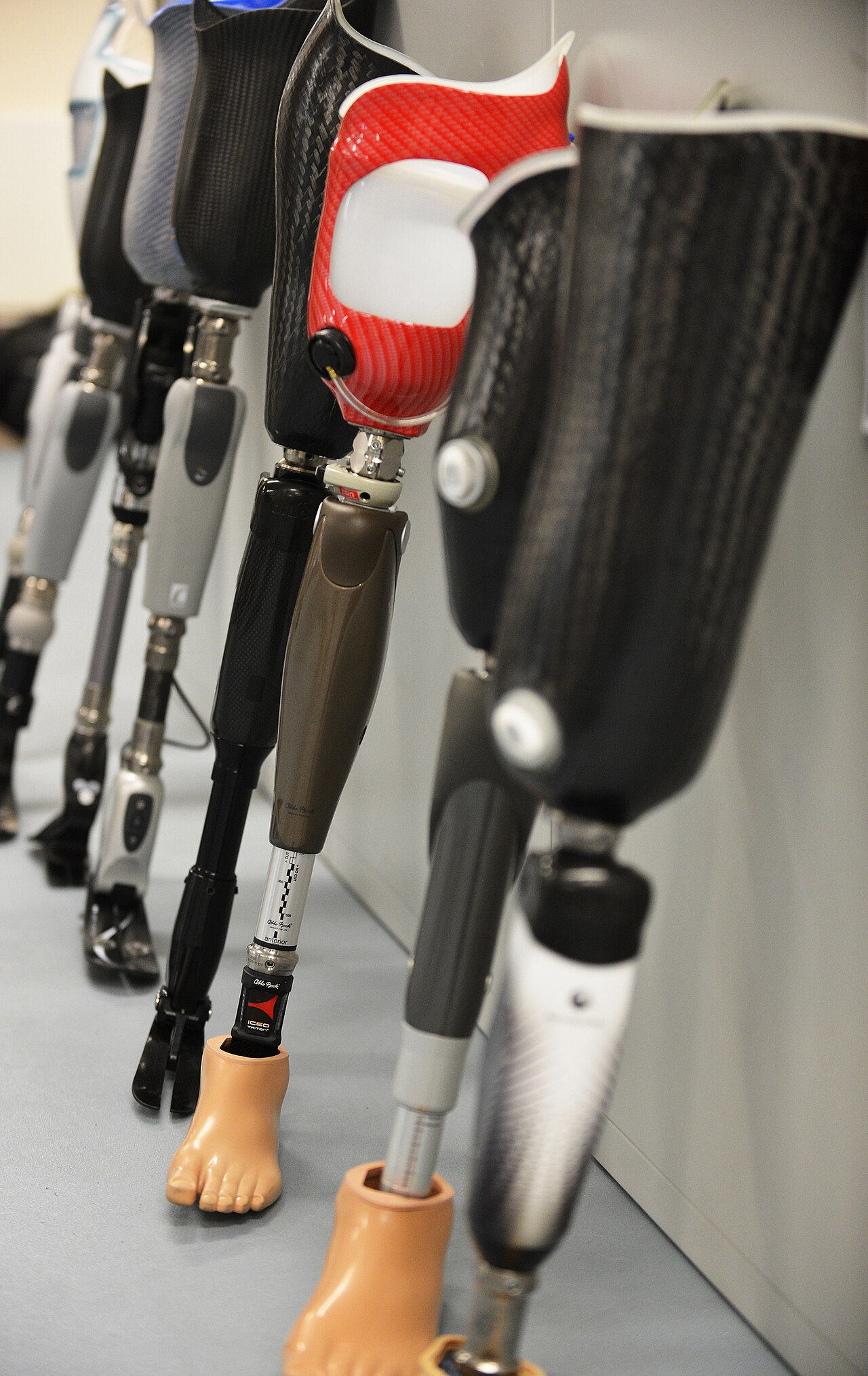 Prosthetic leg with mechanical knee joint